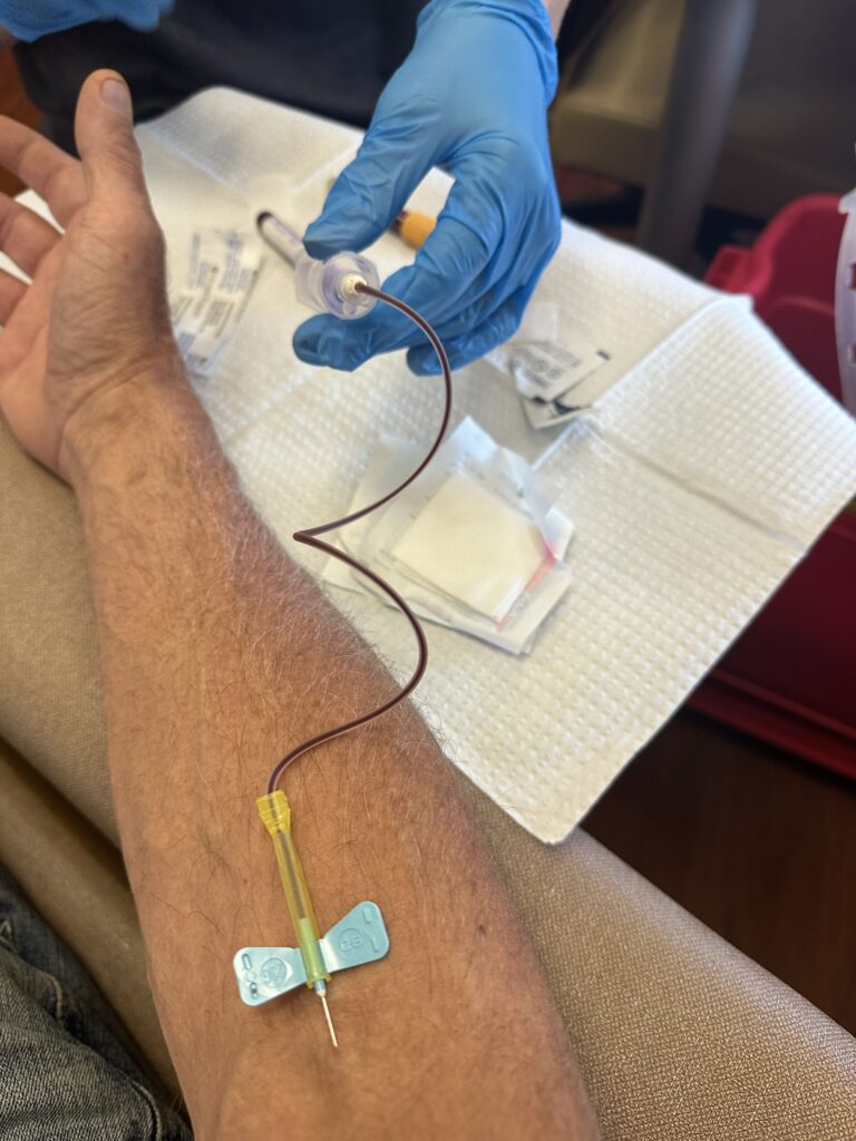 Close-up of a donor's arm with a needle inserted during a blood draw, connected to a collection bag, symbolizing medical care, dialysis, and treatment.